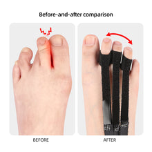 Load image into Gallery viewer, Toe Tractor Bigfoot Bone Overlapping Toe Separator Comfortable Adjustable Cone-toe Toe-bending Orthotics Toe Adjusting Foot Guard