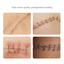 Load image into Gallery viewer, Surgery Disposable Stainless Steel Skin Stapler Nails Skin Stitching Machine Sterile Blank Package Nail Puller
