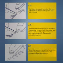 Load image into Gallery viewer, Surgery Disposable Stainless Steel Skin Stapler Nails Skin Stitching Machine Sterile Blank Package Nail Puller