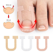 Load image into Gallery viewer, 10sheets Nail Correction Stickers Ingrown Toenail Corrector Patches Treatment Recover Corrector Pedicure Care Tool