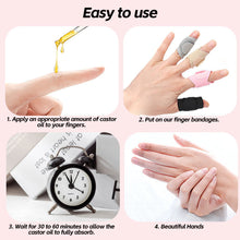 Load image into Gallery viewer, Adjustable Finger Sleeves Loop Strap One-Size-Fits-All Finger Splint Wrap Quick-Release Sports Injury Arthritis Finger Pain Relief