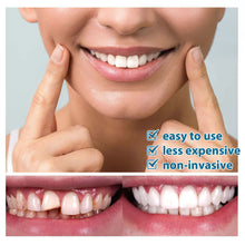 Load image into Gallery viewer, Portable Temporary Tooth Filling Kit Tooth Cap Repair Quick Emergency Dental Repair Putty for Cavities Dental Health Tool Home Use