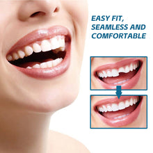 Load image into Gallery viewer, Portable Temporary Tooth Filling Kit Tooth Cap Repair Quick Emergency Dental Repair Putty for Cavities Dental Health Tool Home Use
