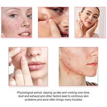 Load image into Gallery viewer, 200Pcs Repair Acne Patches Fade Blemishes Pimple Marks Closed Acne Blemishes Hydrocolloid Star Heart Shaped Cover Acne Pimple Patch