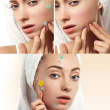 Load image into Gallery viewer, 200Pcs Repair Acne Patches Fade Blemishes Pimple Marks Closed Acne Blemishes Hydrocolloid Star Heart Shaped Cover Acne Pimple Patch