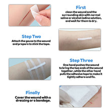 Load image into Gallery viewer, 5 Packs Medical Hypoallergenic Breathable Seamless Tape Tension-Resistant Reduce Scar Tissue Formation Wound Dressing