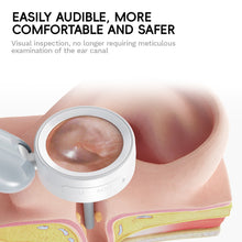 Load image into Gallery viewer, Wireless Smart Otoscope HD Video Portable Ear Canal/Skin/Nasal Inspection Camera Parents/Elderly/Children's/Pet Ear Inspection Home Ear Care Tool