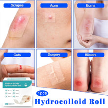 Load image into Gallery viewer, Medical-Grade Hydrocolloid Roll For Wound Care Hydrocolloid Patch Bandages With Self-Adhesive Bed Sore Bandages Highly Absorbent For Burn