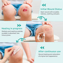 Load image into Gallery viewer, Medical-Grade Hydrocolloid Roll For Wound Care Hydrocolloid Patch Bandages With Self-Adhesive Bed Sore Bandages Highly Absorbent For Burn