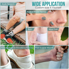 Load image into Gallery viewer, Medical-Grade Hydrocolloid Roll For Wound Care Hydrocolloid Patch Bandages With Self-Adhesive Bed Sore Bandages Highly Absorbent For Burn