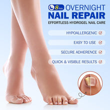 Load image into Gallery viewer, Toenail Correction Stickers Nail Repair Care Stickers Pain Relief & Protection For Daily Comfort Sports & Activity Protection Toe Nail Issues Nail Recovery Aid