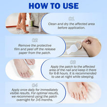 Load image into Gallery viewer, Toenail Correction Stickers Nail Repair Care Stickers Pain Relief & Protection For Daily Comfort Sports & Activity Protection Toe Nail Issues Nail Recovery Aid