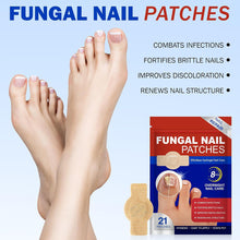 Load image into Gallery viewer, Toenail Correction Stickers Nail Repair Care Stickers Pain Relief & Protection For Daily Comfort Sports & Activity Protection Toe Nail Issues Nail Recovery Aid