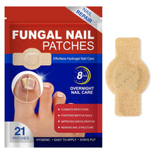 Load image into Gallery viewer, Toenail Correction Stickers Nail Repair Care Stickers Pain Relief & Protection For Daily Comfort Sports & Activity Protection Toe Nail Issues Nail Recovery Aid
