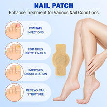 Load image into Gallery viewer, Toenail Correction Stickers Nail Repair Care Stickers Pain Relief & Protection For Daily Comfort Sports & Activity Protection Toe Nail Issues Nail Recovery Aid