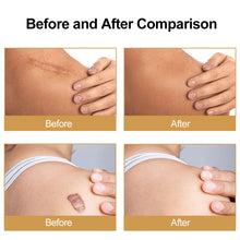 Load image into Gallery viewer, Medical-Grade Silicone Gel Sheet for Fades Superficial Scars Scar Tape for Keloid Removal Patch Breathable Body Care For Burn