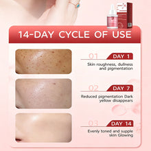Load image into Gallery viewer, Nicotinamide Facial Serum Melanin Removal Reduce Dark Spots Even Skin Tone Brightening Rejuvenation Anti Acne Face Essence 30ml