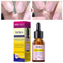 Load image into Gallery viewer, 15ml Nail Cuticle Nutrient Oil Nourish Repair Damaged Nail Care Nutrition Oil Treatment Moisturizes Stronger Nails in 2 Weeks