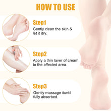 Load image into Gallery viewer, Ultra-Hydrating 60% Urea Avocado Oil Foot Cream Aloe Vera for Softening Dry Cracked Feet Gentle Exfoliation Daily Foot Care