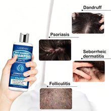 Load image into Gallery viewer, 300ml Deep Clarifying Shampoo Non-greasy Repair Hair Clippings Remove Greasy Hair Dense Foam Deep Cleanses Hair