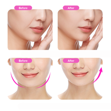 Load image into Gallery viewer, 1pair Anti Wrinkle Patches Reusable Silicone Facial Lifting Pads Improve Nasolabial Fold Prevent Face Skin Sag Skincare Tools