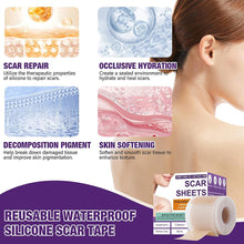 Load image into Gallery viewer, 1 Roll Silicone Self-Adhesive Waterproof Silicone Scar Sheets Covering Patch Waterproof Breathable Body Hand Skin Care Tape