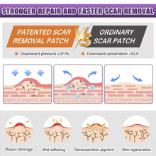 Load image into Gallery viewer, 1 Roll Silicone Self-Adhesive Waterproof Silicone Scar Sheets Covering Patch Waterproof Breathable Body Hand Skin Care Tape