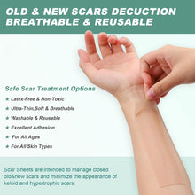 Load image into Gallery viewer, Silicone Self-Adhesive Waterproof Silicone Scar Sheets Covering Patch Waterproof Breathable Body Hand Skin Care Tape