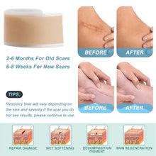 Load image into Gallery viewer, Silicone Self-Adhesive Waterproof Silicone Scar Sheets Covering Patch Waterproof Breathable Body Hand Skin Care Tape