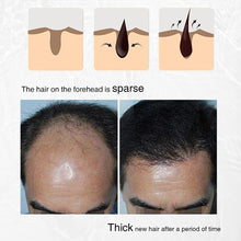 Load image into Gallery viewer, Onion Rosemary Black Rice Hair Spray Scalp Essence for Root Strengthening Anti-Breakage Hair Care Spray No Rinse Daily Use for Hair Fall Concern