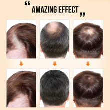 Load image into Gallery viewer, Ginger Essence Hair Growth Essential Oil Fast Regrowth Oil Serum Hair Loss Medicine Enhancer Care Beauty Scalp Treatment