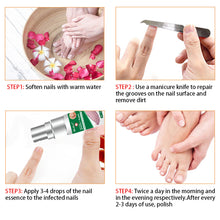 Load image into Gallery viewer, Nail Fungus Anti Infection Feet Care Essence Nails Foot Repair Toe Nail Fungal Treatment Removal Gel Paronychia Onychomycosis