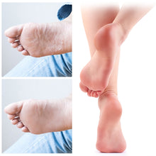 Load image into Gallery viewer, Pedicure Tools Remove Dead Skin From Grinding Foot Artifact Peeling Pedicure Exfoliating Tool Foot Care Exfoliate Tools