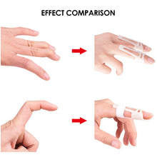 Load image into Gallery viewer, Mallet Finger Splints Brace Protector Adjustable Broken Fingers Joint Stabilizer Straightening Arthritis Knuckle