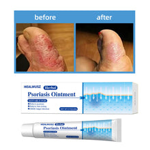 Load image into Gallery viewer, Antibacterial Psoriasis Cream Herbal Effective Relief Dermatitis Eczema Antipruritic Treatment Urticaria Desquamation Skin Care