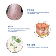 Load image into Gallery viewer, Antibacterial Psoriasis Cream Herbal Effective Relief Dermatitis Eczema Antipruritic Treatment Urticaria Desquamation Skin Care