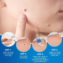 Load image into Gallery viewer, Painless Skin Tag Remover Cream Mole Skin Dark Spot Wart Remover Cream Serum Freckle Face Wart Tag Treatment Removal