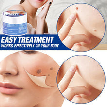 Load image into Gallery viewer, Painless Skin Tag Remover Cream Mole Skin Dark Spot Wart Remover Cream Serum Freckle Face Wart Tag Treatment Removal