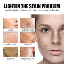 Load image into Gallery viewer, Whitening Freckles Green Cream Remove Dark Lightening Spot Lightening Melanin Brightening Melasma Remover Moisturizing Cream
