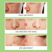 Load image into Gallery viewer, Whitening Freckles Green Cream Remove Dark Lightening Spot Lightening Melanin Brightening Melasma Remover Moisturizing Cream