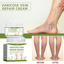 Load image into Gallery viewer, Varicose Vein Repair Cream Massage The Legs To Relieve Pain Clear The Meridian Venous Red Blood Silk Spider Leg Repair Cream
