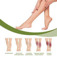 Load image into Gallery viewer, Varicose Vein Repair Cream Massage The Legs To Relieve Pain Clear The Meridian Venous Red Blood Silk Spider Leg Repair Cream