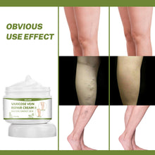 Load image into Gallery viewer, Varicose Vein Repair Cream Massage The Legs To Relieve Pain Clear The Meridian Venous Red Blood Silk Spider Leg Repair Cream