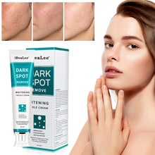 Load image into Gallery viewer, Whitening Freckle Cream Face Moisturizer Remove Dark Spots Melanin Melasma Remover Brightening Skin Repair Anti-Aging