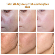 Load image into Gallery viewer, Whitening Freckle Cream Face Moisturizer Remove Dark Spots Melanin Melasma Remover Brightening Skin Repair Anti-Aging