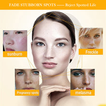 Load image into Gallery viewer, Whitening Freckle Cream Face Moisturizer Remove Dark Spots Melanin Melasma Remover Brightening Skin Repair Anti-Aging