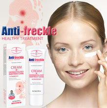 Load image into Gallery viewer, Nicotinamide Freckle Cream Facial Brightening Moisturizing Cream Whitening Freckle Cream Anti-Aging Skin Care Cosmetics