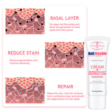 Load image into Gallery viewer, Nicotinamide Freckle Cream Facial Brightening Moisturizing Cream Whitening Freckle Cream Anti-Aging Skin Care Cosmetics