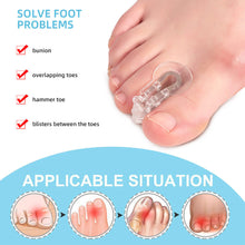 Load image into Gallery viewer, Toe Splitter Thumb Valgus Corrector Big Foot Bone Orthosis Clip Toe Pad Foot Care Toe Separator Health Care