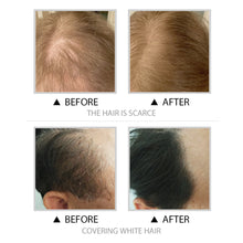 Load image into Gallery viewer, 5-color Hairline Shadow Powder Filling Forehead Hairline Powder Waterproof Sweatproof Hairline Filling Powder